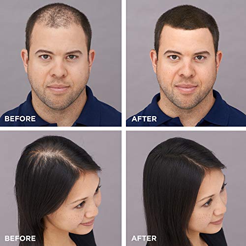 TOPPIK Hair Building Fibers for Instantly Fuller Hair (BLACK), 12 g, Fill In Fine or Thinning Hair, Instantly Thicker Looking Hair, Multiple Shades for Men & Women